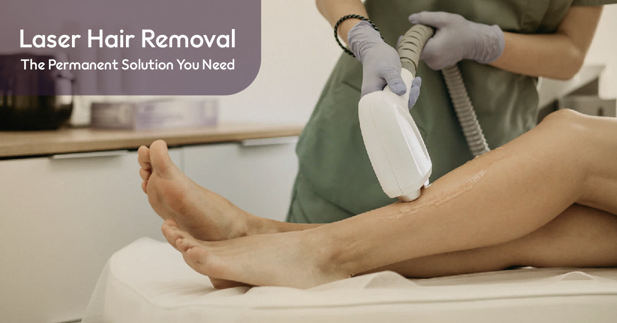 laser hair removal
