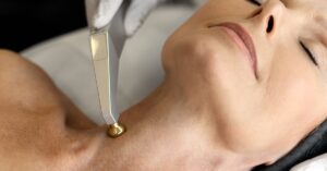 CO2 Treatment in Brea