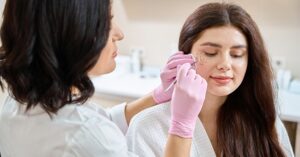 Acne treatment in Covina