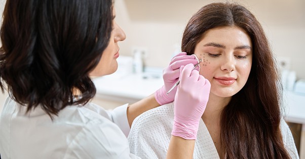 Acne treatment in Covina